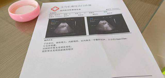 上海正规医院能做试管供卵吗要多少钱呢