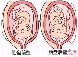 上海供卵试管移植，2022年上海做三代供卵试管婴儿多少钱？